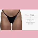 Bikini & Wellness